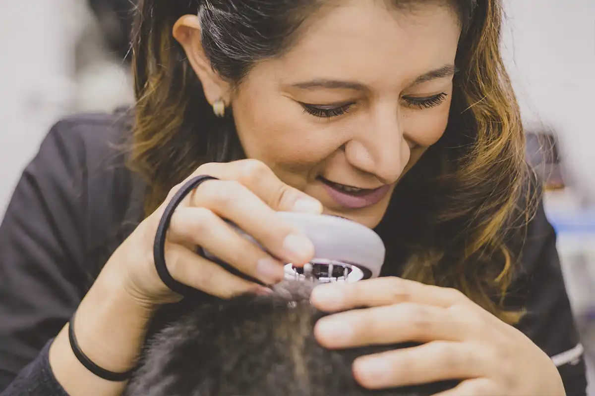 Biopsias de Pelo Diagnóstico Dermatológico - Skintopía