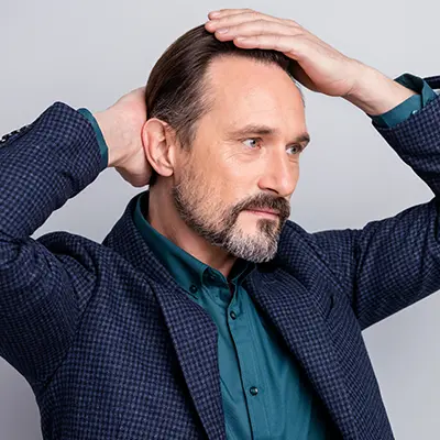 Alopecia Androgénica - Genética, Tratamientos en Skintopía