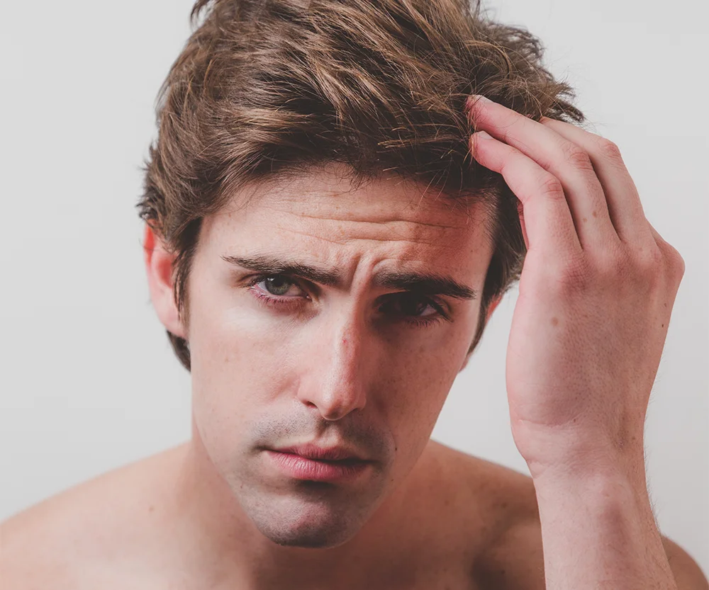 Soluciones para problemas de cabello en hombres - Clínica Skintopía CDMX